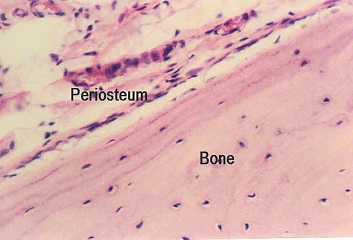 bone3