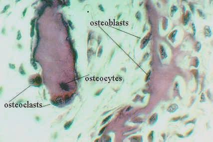 devbone8.jpg (29538 bytes)